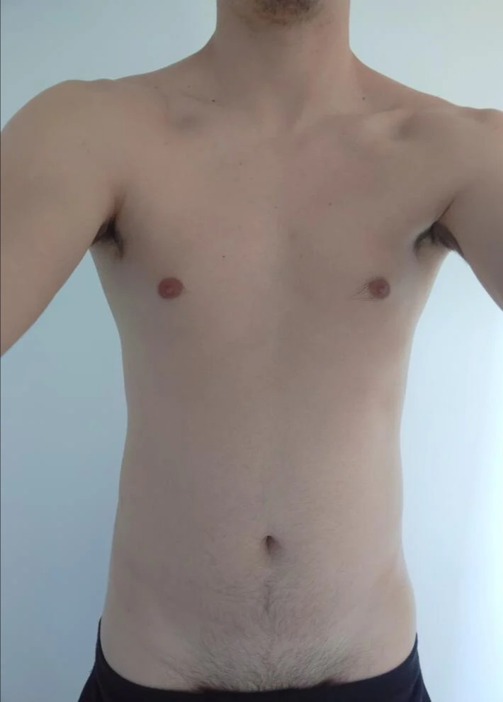 Profilo di Frederico